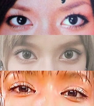 ローラの目の整形画像